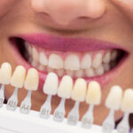 Teeth Whitening Maintenance Tips